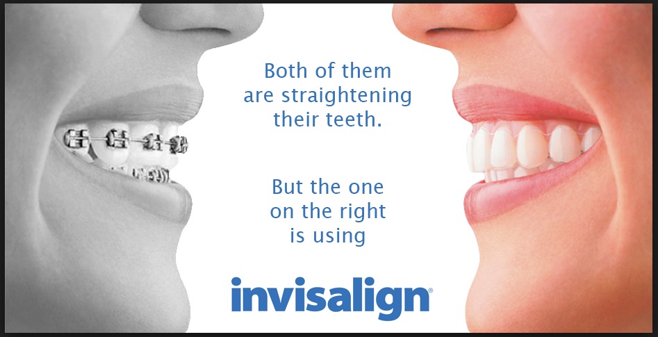 Invisalign Straight Smiles Orthodonics